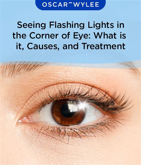 flases|flashes in eye.